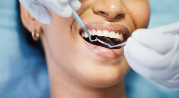 Best Knocked-Out Tooth (Avulsed Tooth) Treatment in Rayville, LA